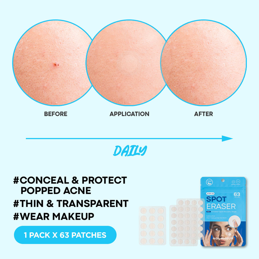 Step 2: NOLAHOUR Hydrocolloid Invisible Patch