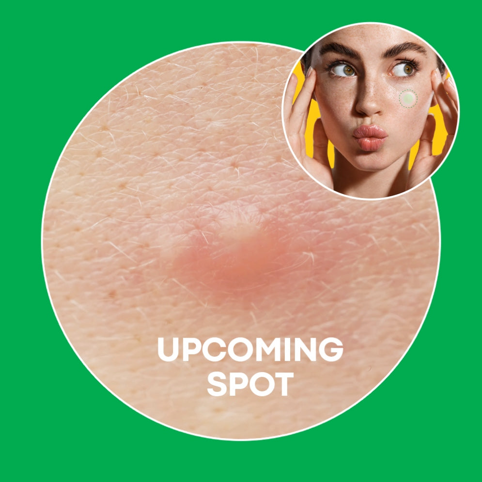 Step 1: NOLAHOUR Green Micropoint Pimple Patch